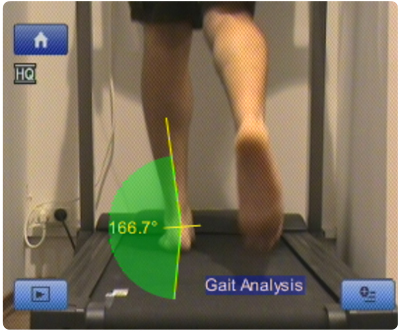Gait Analysis